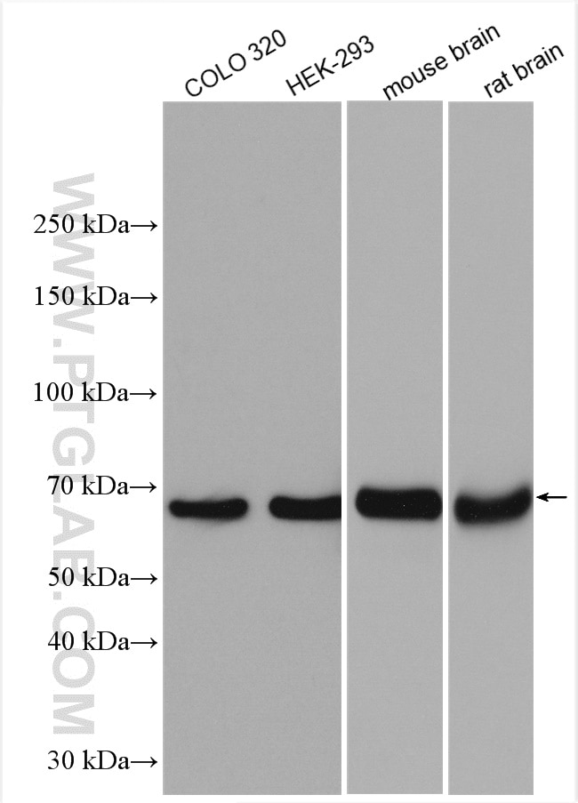 Western Blot (WB) analysis of various lysates using KGA/GAC Polyclonal antibody (12855-1-AP)
