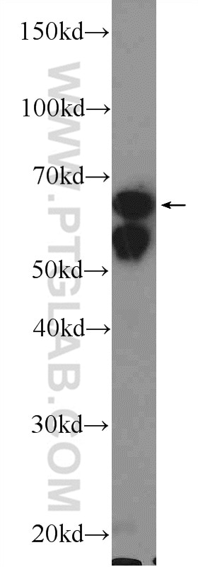 Western Blot (WB) analysis of COLO 320 cells using KGA/GAC Polyclonal antibody (12855-1-AP)