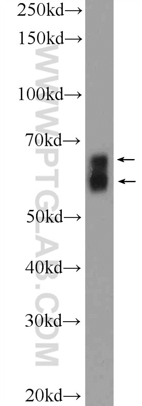 Western Blot (WB) analysis of HEK-293 cells using KGA/GAC Polyclonal antibody (12855-1-AP)