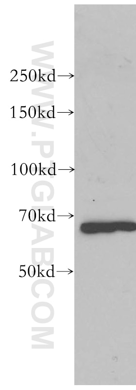 Western Blot (WB) analysis of mouse kidney tissue using KGA/GAC Polyclonal antibody (12855-1-AP)