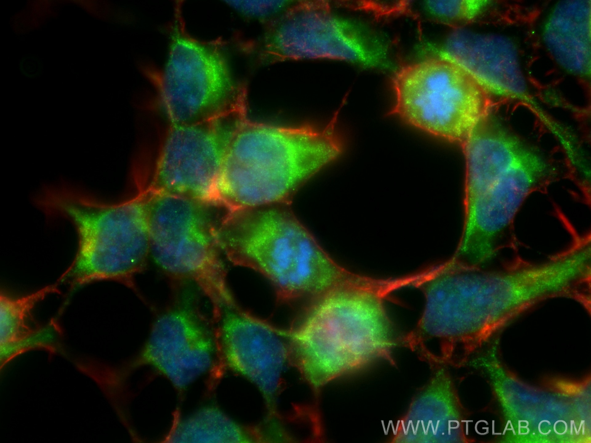 Immunofluorescence (IF) / fluorescent staining of HEK-293 cells using KGA-Specific Polyclonal antibody (20170-1-AP)