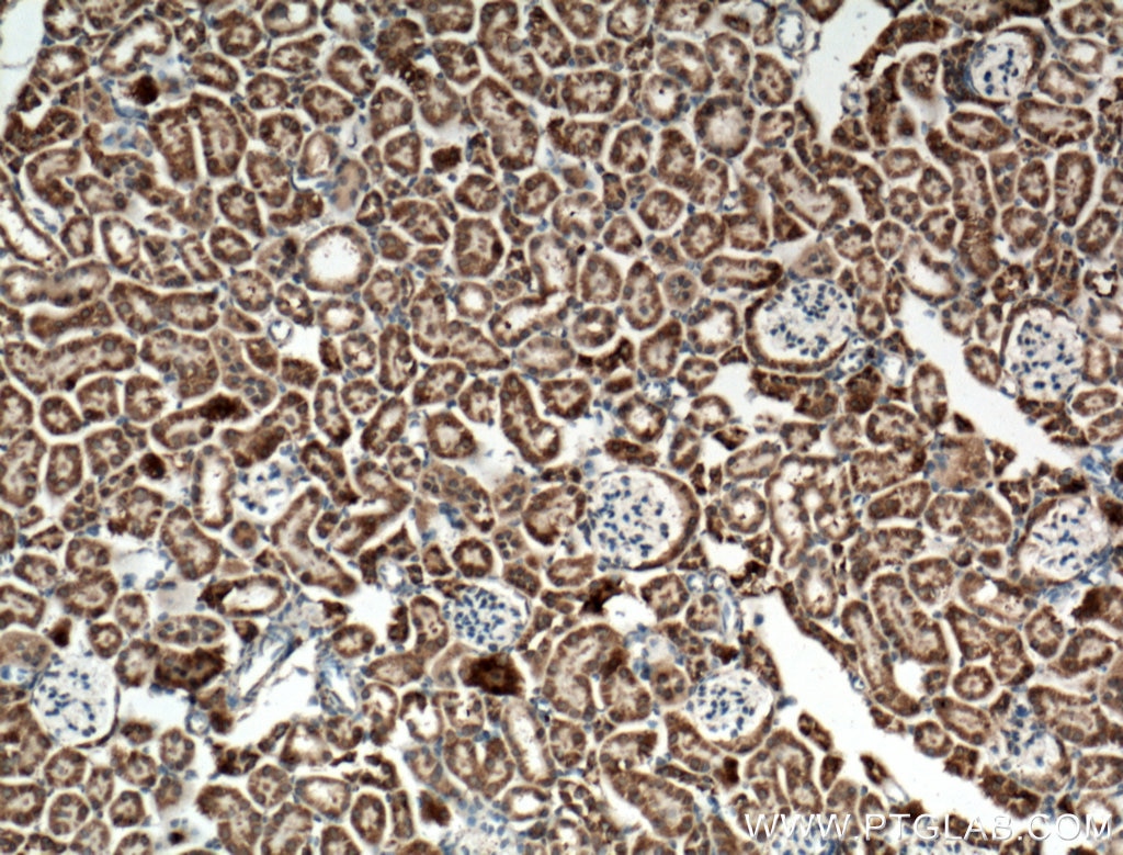 Immunohistochemistry (IHC) staining of mouse kidney tissue using KGA-Specific Polyclonal antibody (20170-1-AP)