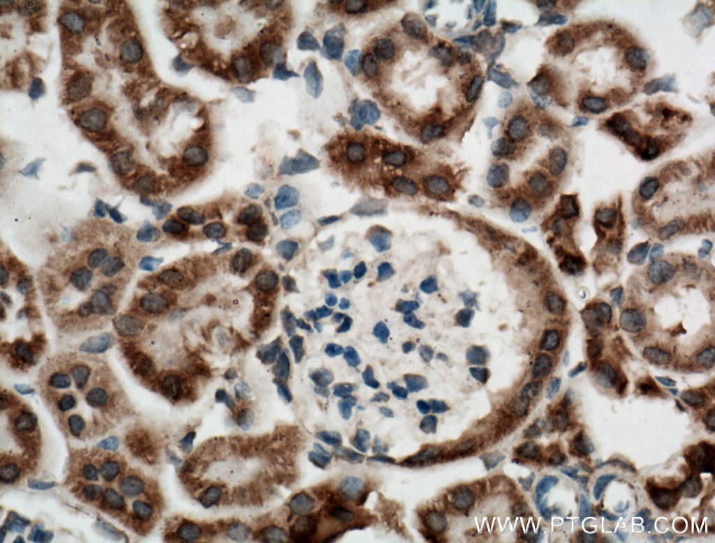 Immunohistochemistry (IHC) staining of mouse kidney tissue using KGA-Specific Polyclonal antibody (20170-1-AP)