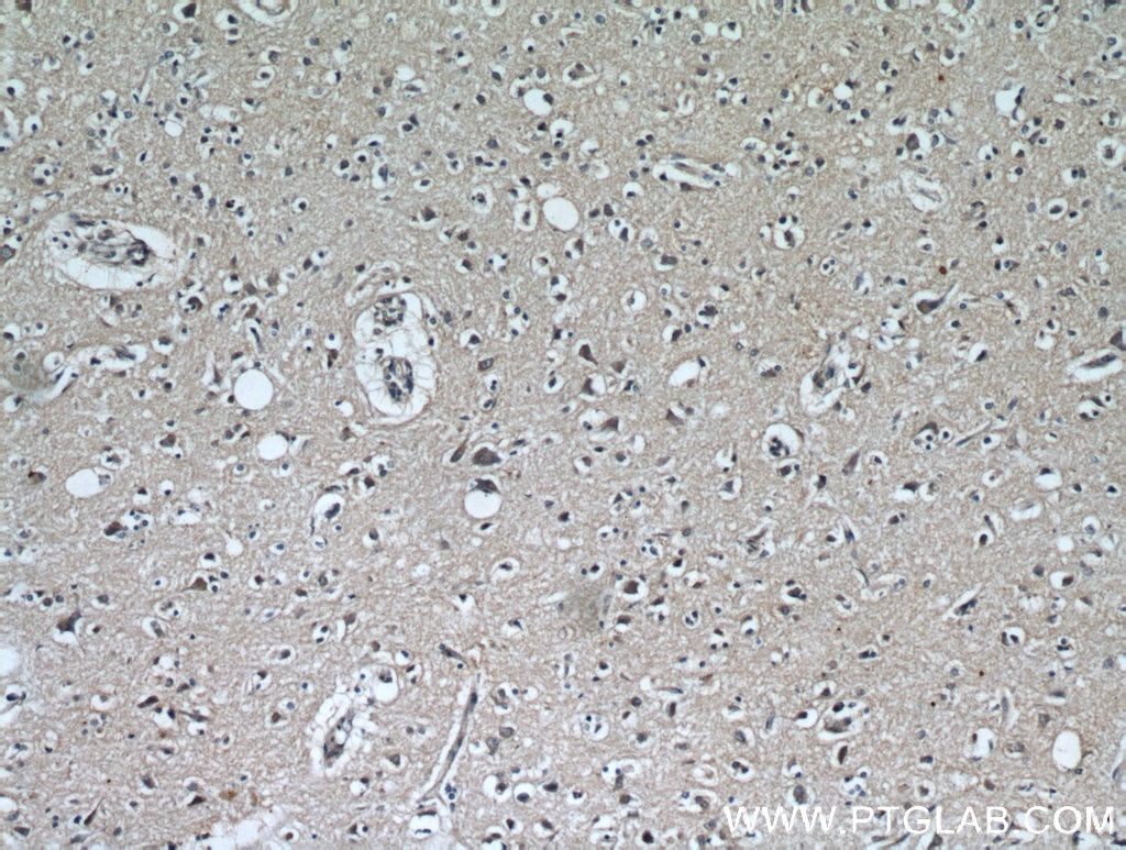 Immunohistochemistry (IHC) staining of human brain tissue using KGA-Specific Polyclonal antibody (20170-1-AP)