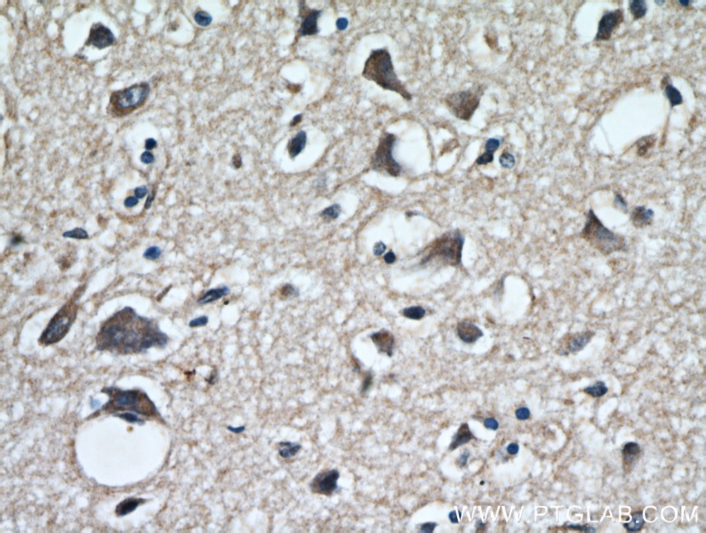 IHC staining of human brain using 20170-1-AP