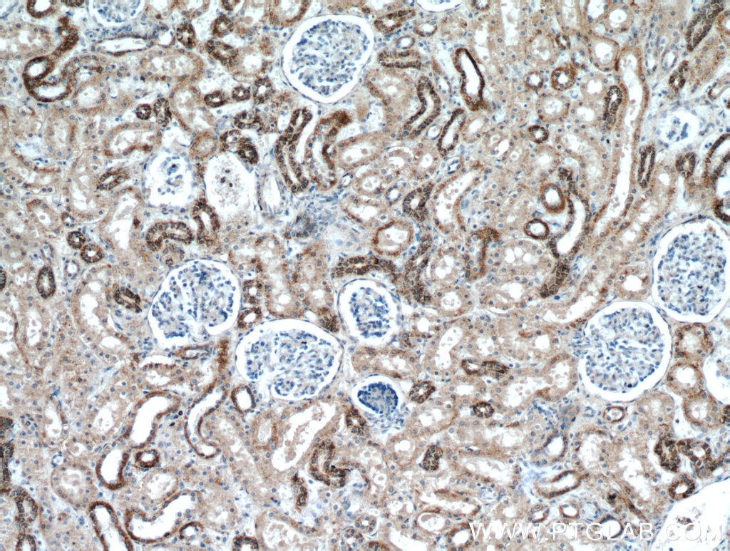 Immunohistochemistry (IHC) staining of human kidney tissue using KGA-Specific Polyclonal antibody (20170-1-AP)