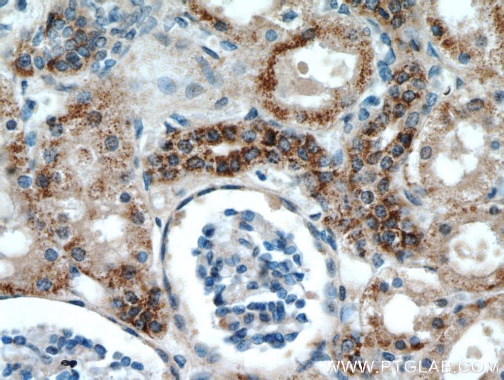 Immunohistochemistry (IHC) staining of human kidney tissue using KGA-Specific Polyclonal antibody (20170-1-AP)