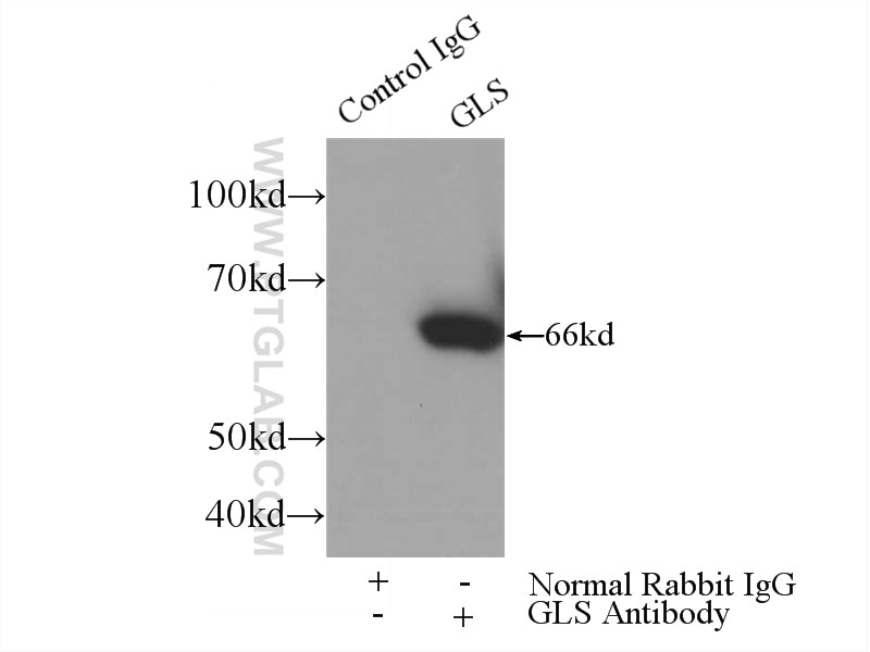 IP experiment of HEK-293 using 20170-1-AP