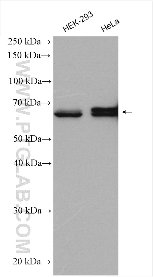 Western Blot (WB) analysis of various lysates using KGA-Specific Polyclonal antibody (20170-1-AP)
