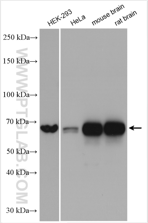 Western Blot (WB) analysis of various lysates using KGA-Specific Polyclonal antibody (20170-1-AP)