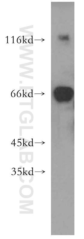 Western Blot (WB) analysis of HEK-293 cells using KGA-Specific Polyclonal antibody (20170-1-AP)