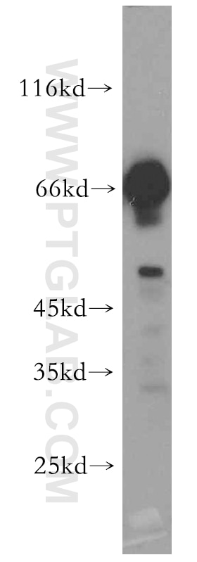 Western Blot (WB) analysis of mouse kidney tissue using KGA-Specific Polyclonal antibody (20170-1-AP)