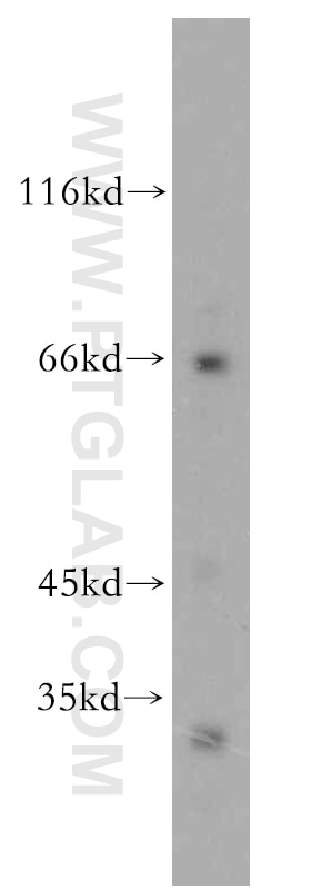 Western Blot (WB) analysis of human heart tissue using KGA-Specific Polyclonal antibody (20170-1-AP)