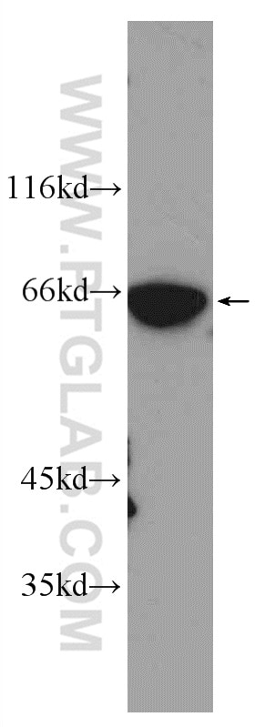 Western Blot (WB) analysis of human brain tissue using KGA-Specific Polyclonal antibody (20170-1-AP)