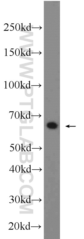 Western Blot (WB) analysis of K-562 cells using KGA-Specific Polyclonal antibody (20170-1-AP)