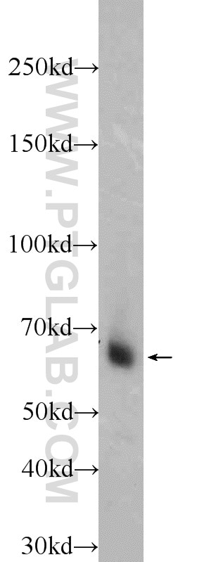 WB analysis of mouse brain using 20170-1-AP