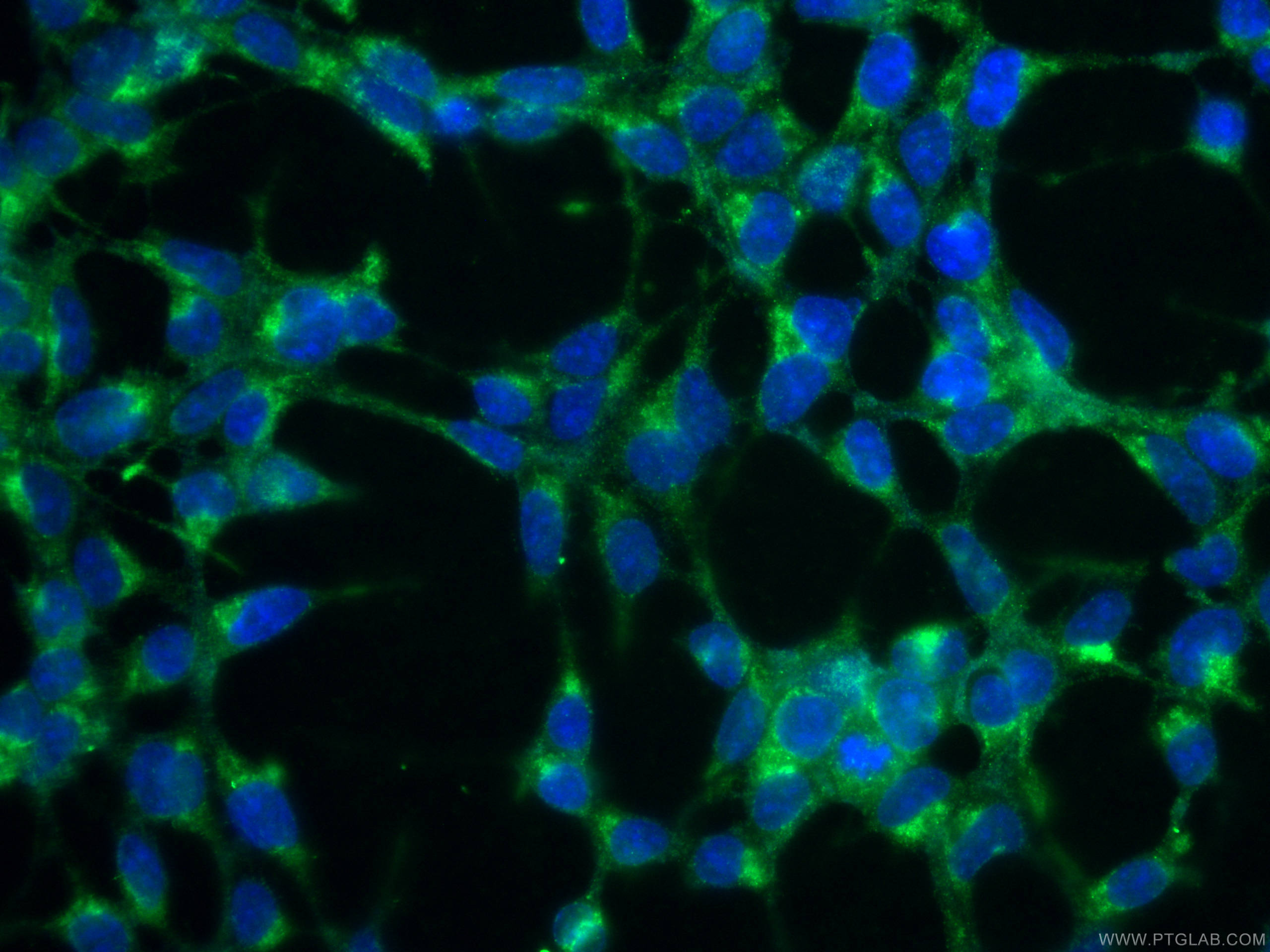 Immunofluorescence (IF) / fluorescent staining of HEK-293 cells using KGA/GAM/GAC Polyclonal antibody (23549-1-AP)