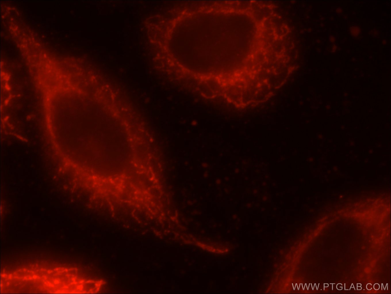 Immunofluorescence (IF) / fluorescent staining of HeLa cells using KGA/GAM/GAC Polyclonal antibody (23549-1-AP)
