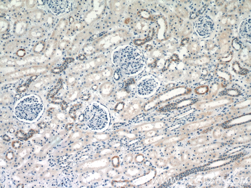 Immunohistochemistry (IHC) staining of human kidney tissue using KGA/GAM/GAC Polyclonal antibody (23549-1-AP)