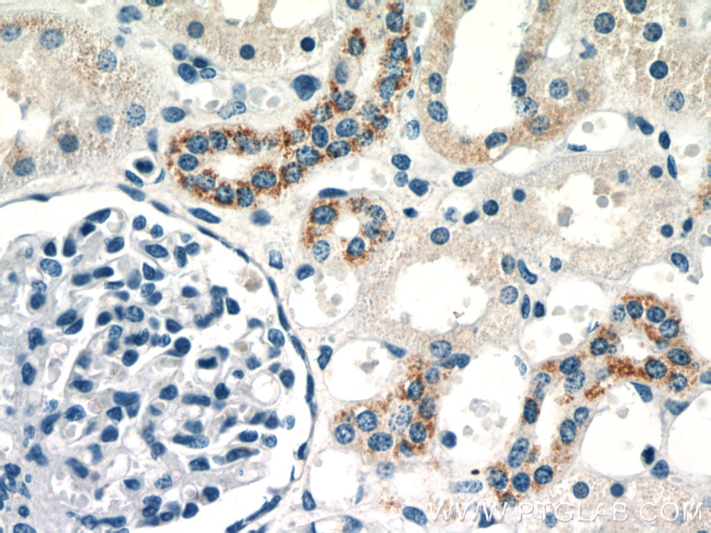 Immunohistochemistry (IHC) staining of human kidney tissue using KGA/GAM/GAC Polyclonal antibody (23549-1-AP)