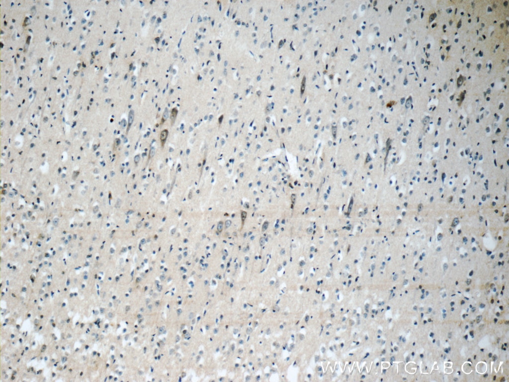 Immunohistochemistry (IHC) staining of human brain tissue using KGA/GAM/GAC Polyclonal antibody (23549-1-AP)