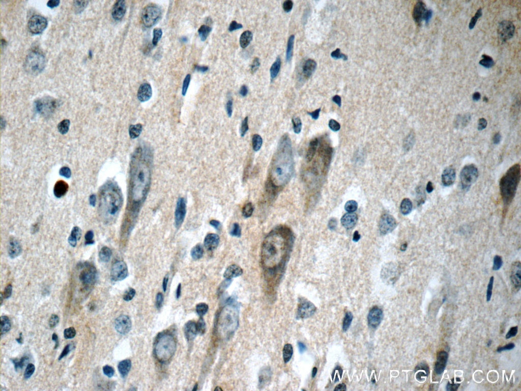 Immunohistochemistry (IHC) staining of human brain tissue using KGA/GAM/GAC Polyclonal antibody (23549-1-AP)