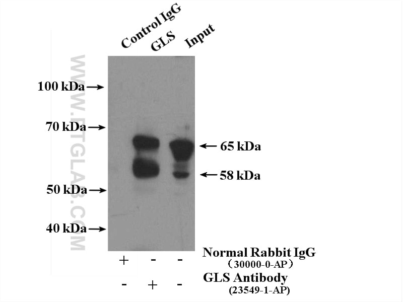 Immunoprecipitation (IP) experiment of HEK-293 cells using KGA/GAM/GAC Polyclonal antibody (23549-1-AP)