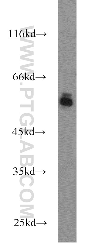 Western Blot (WB) analysis of HeLa cells using KGA/GAM/GAC Polyclonal antibody (23549-1-AP)