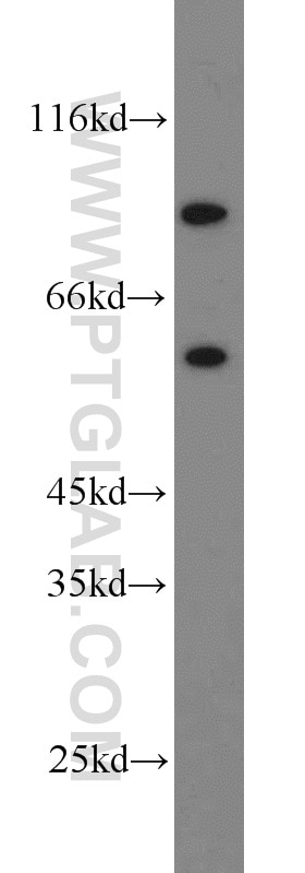 Western Blot (WB) analysis of HEK-293 cells using KGA/GAM/GAC Polyclonal antibody (23549-1-AP)