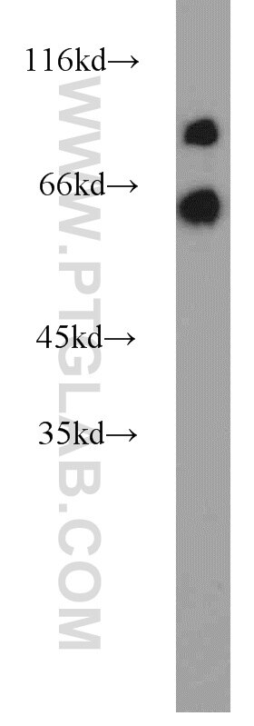 Western Blot (WB) analysis of mouse brain tissue using KGA/GAM/GAC Polyclonal antibody (23549-1-AP)