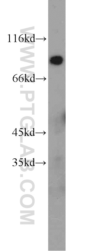 Western Blot (WB) analysis of mouse liver tissue using KGA/GAM/GAC Polyclonal antibody (23549-1-AP)