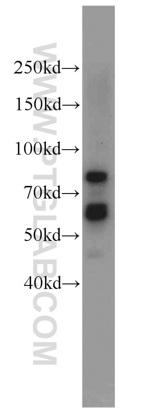 Western Blot (WB) analysis of rat brain tissue using KGA/GAM/GAC Polyclonal antibody (23549-1-AP)