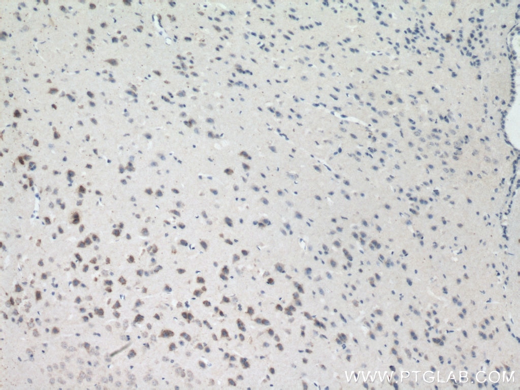 Immunohistochemistry (IHC) staining of mouse brain tissue using KGA/GAC Monoclonal antibody (66265-1-Ig)