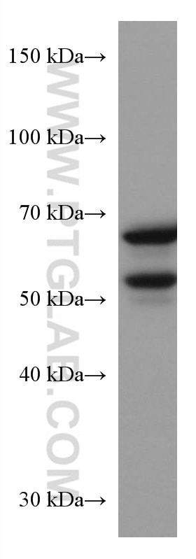 Western Blot (WB) analysis of NIH/3T3 cells using KGA/GAC Monoclonal antibody (66265-1-Ig)
