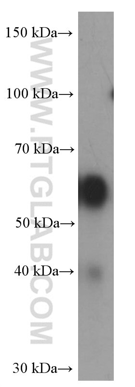 Western Blot (WB) analysis of rat liver tissue using KGA/GAC Monoclonal antibody (66265-1-Ig)