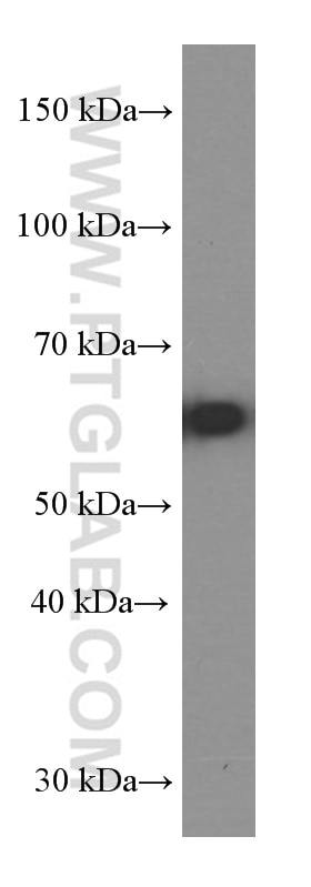 Western Blot (WB) analysis of fetal human brain tissue using KGA/GAC Monoclonal antibody (66265-1-Ig)