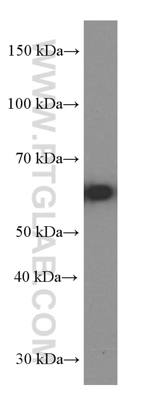 WB analysis of fetal human brain using 66265-1-Ig