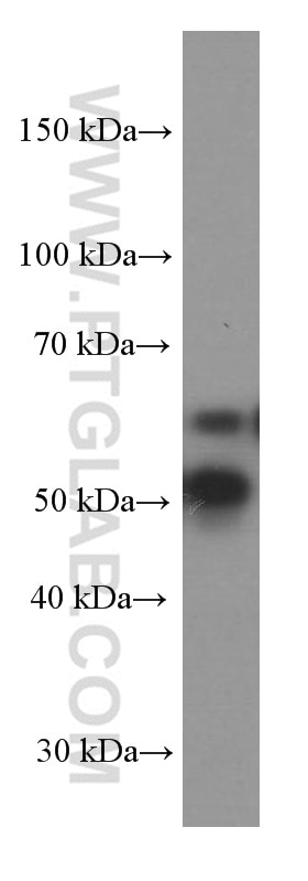Western Blot (WB) analysis of U-251 cells using KGA/GAC Monoclonal antibody (66265-1-Ig)