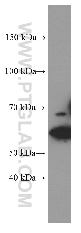 Western Blot (WB) analysis of HEK-293 cells using KGA/GAC Monoclonal antibody (66265-1-Ig)