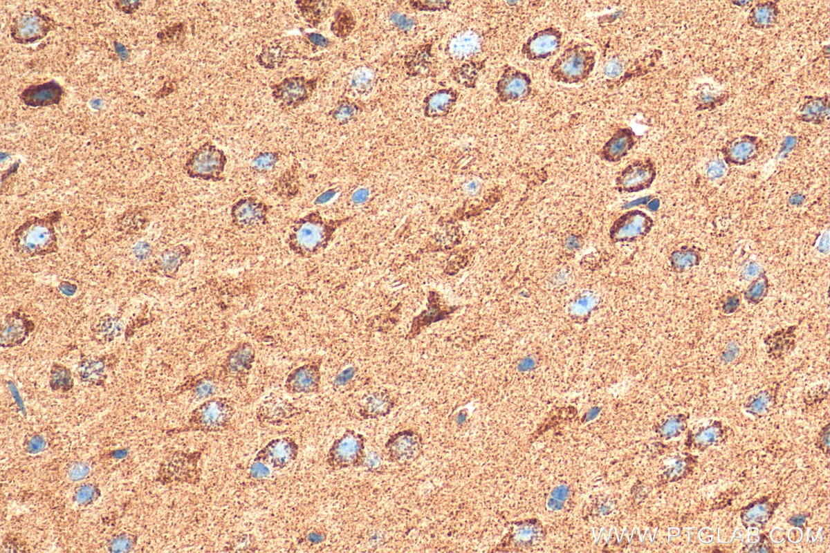 Immunohistochemistry (IHC) staining of mouse brain tissue using GLS Recombinant antibody (81486-1-RR)