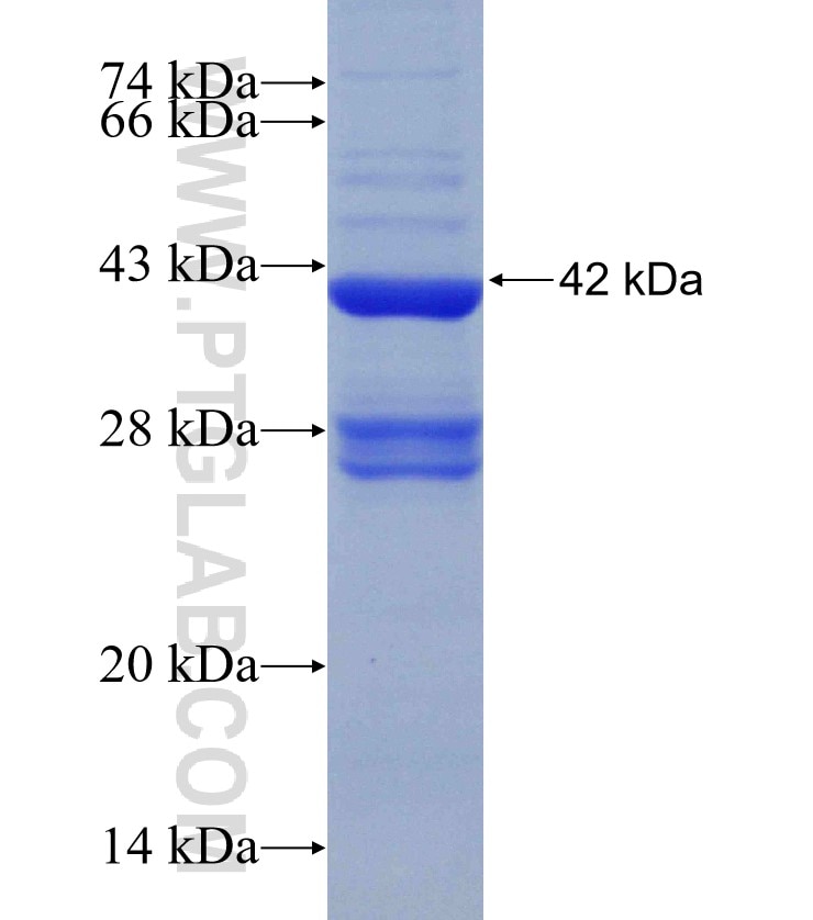 GLS fusion protein Ag31167 SDS-PAGE