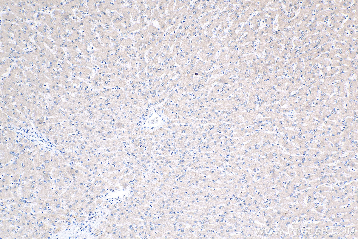 IHC staining of human liver using 20171-1-AP