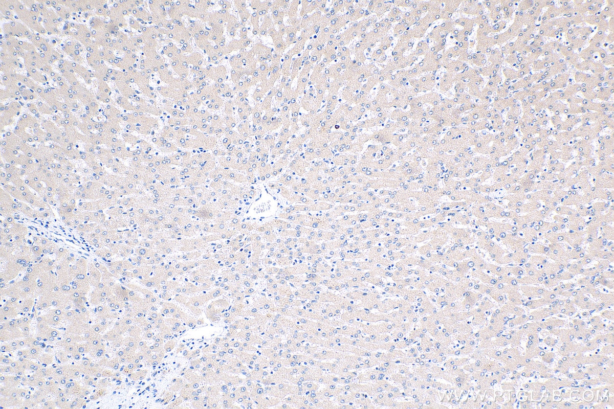 Immunohistochemistry (IHC) staining of human liver tissue using GLS2 Polyclonal antibody (20171-1-AP)