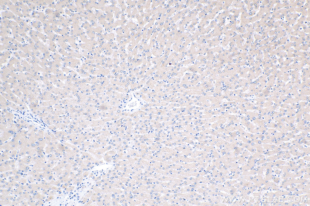 Immunohistochemistry (IHC) staining of human liver tissue using GLS2 Polyclonal antibody (20171-1-AP)