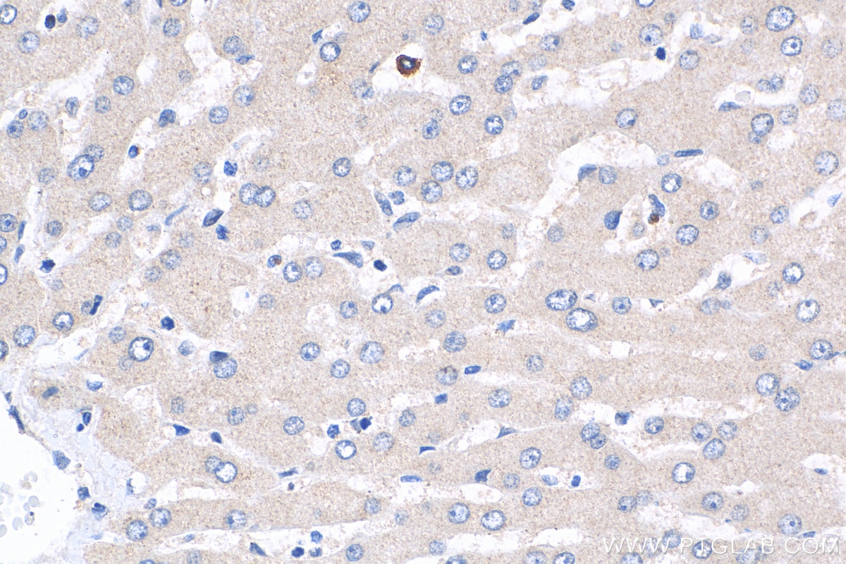 Immunohistochemistry (IHC) staining of human liver tissue using GLS2 Polyclonal antibody (20171-1-AP)