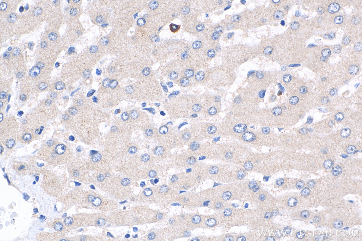 IHC staining of human liver using 20171-1-AP