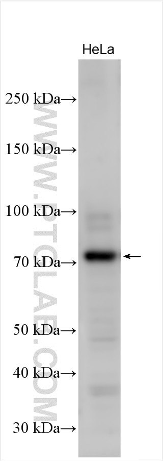 Western Blot (WB) analysis of HeLa cells using GLS2 Polyclonal antibody (20171-1-AP)