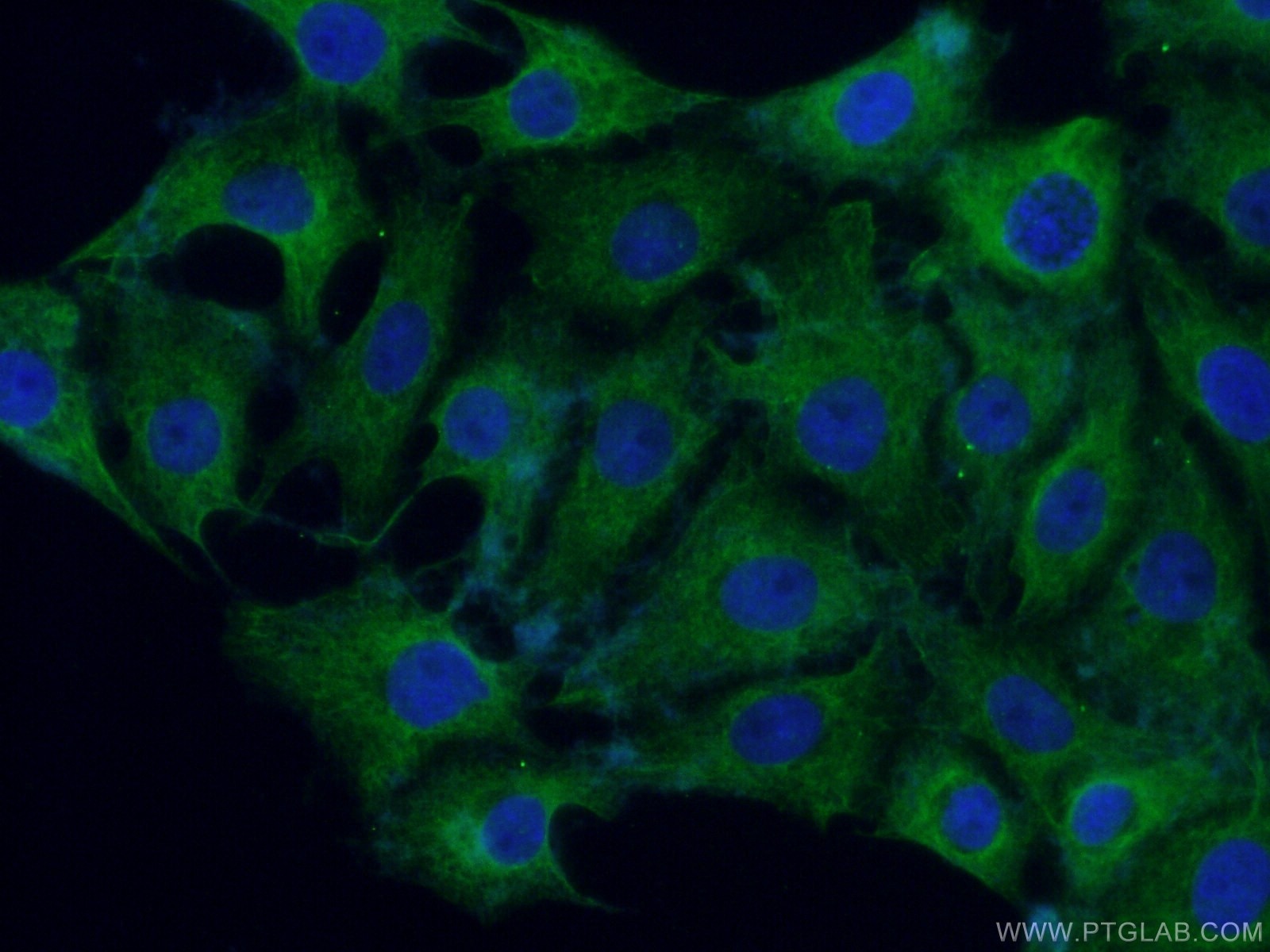 Immunofluorescence (IF) / fluorescent staining of SH-SY5Y cells using GLT25D1 Polyclonal antibody (16768-1-AP)