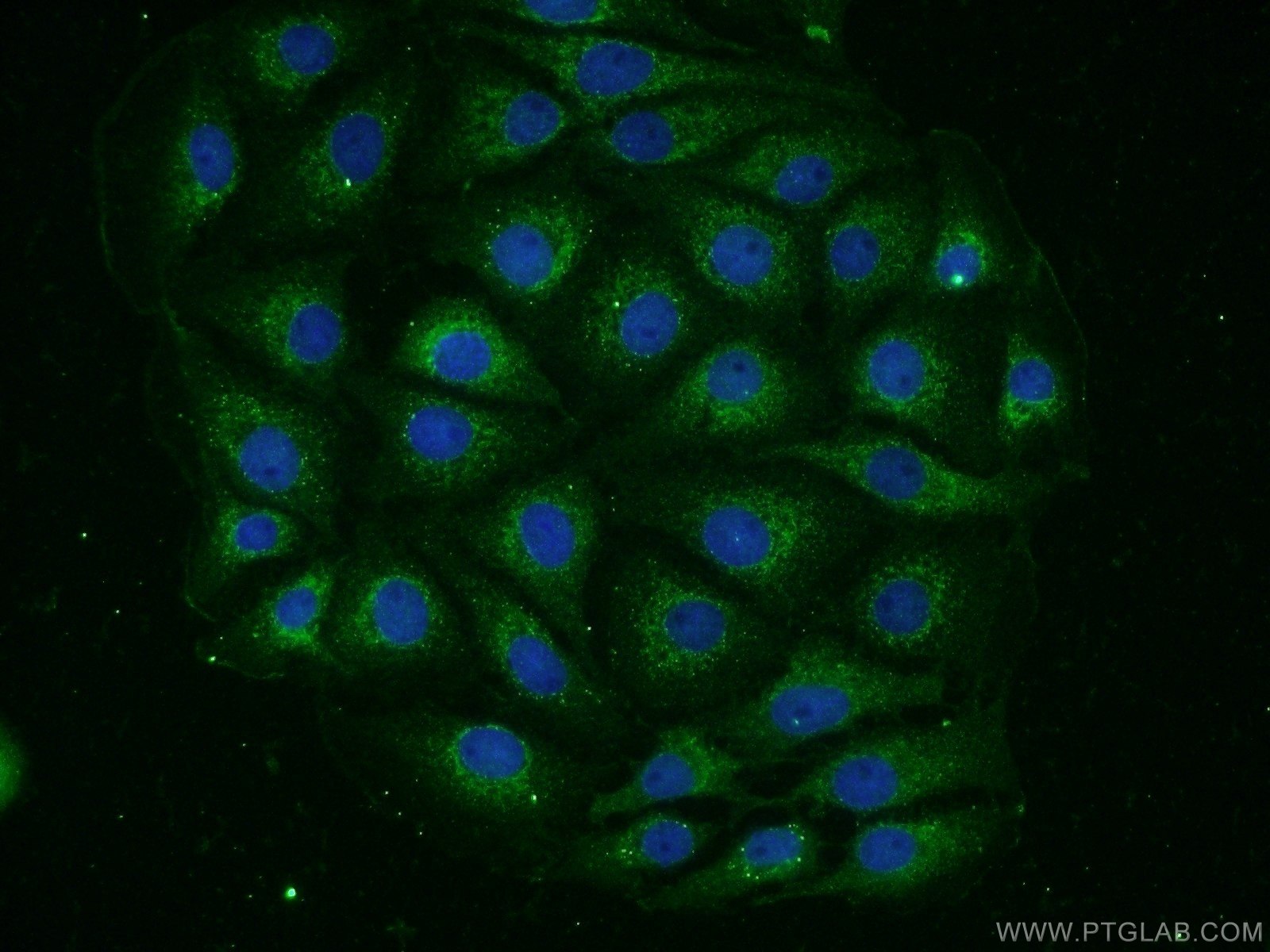 Immunofluorescence (IF) / fluorescent staining of SH-SY5Y cells using GLT25D1 Polyclonal antibody (16768-1-AP)