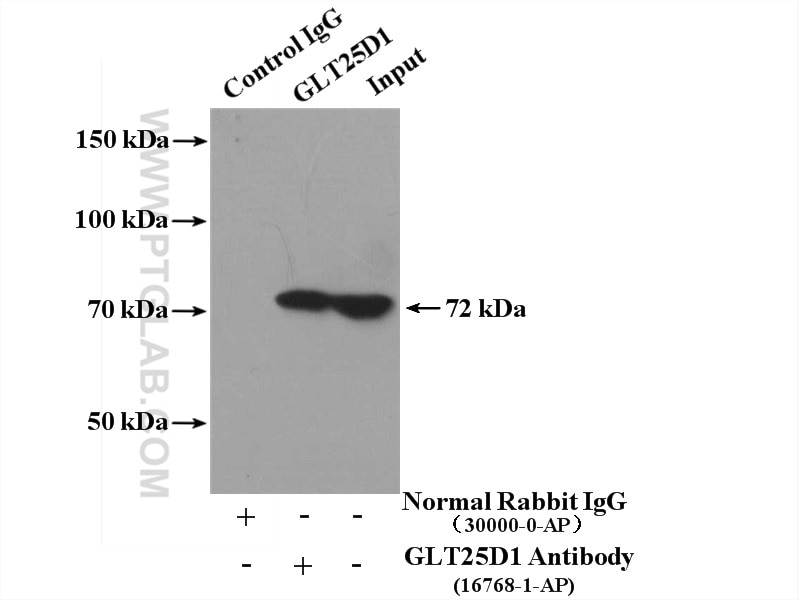 Immunoprecipitation (IP) experiment of HeLa cells using GLT25D1 Polyclonal antibody (16768-1-AP)